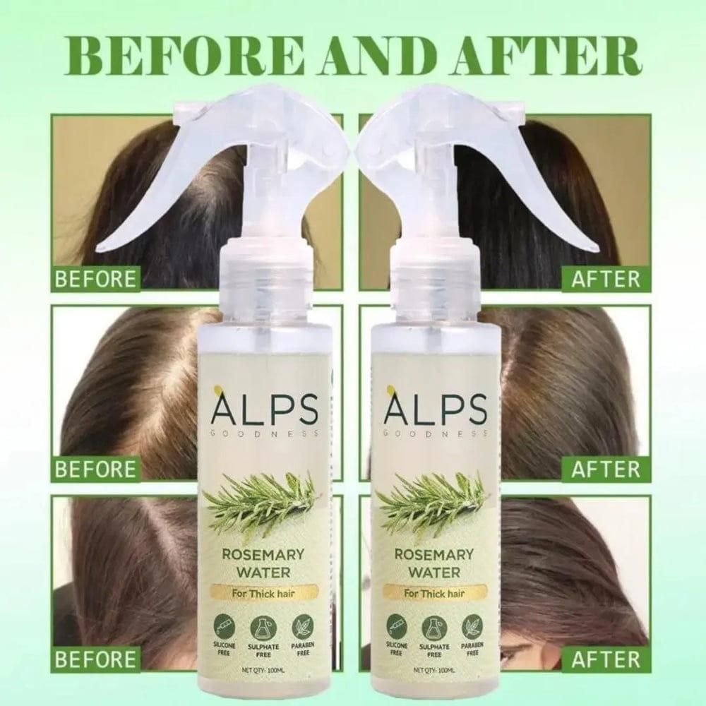 Alps Goodness Rosemary Water Hairspray for Hair growth - Pack of 3 (100 ml each)